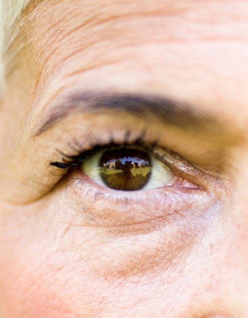 درمان-دور-چشم؛-جوانسازی-و-رفع-تیرگی-و-سیاهی