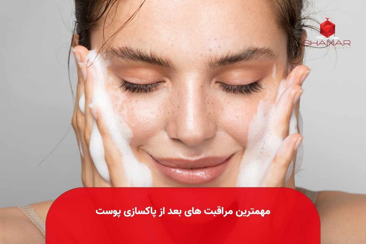 مهمترین-مراقبت-های-بعد-از-پاکسازی-پوست