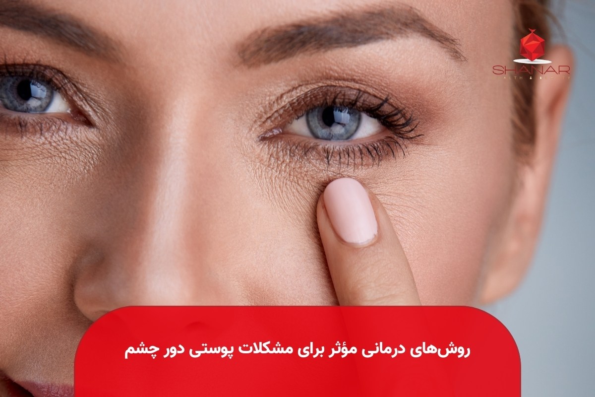 روش‌های-درمانی-مؤثر-برای-مشکلات-پوستی-دور-چشم