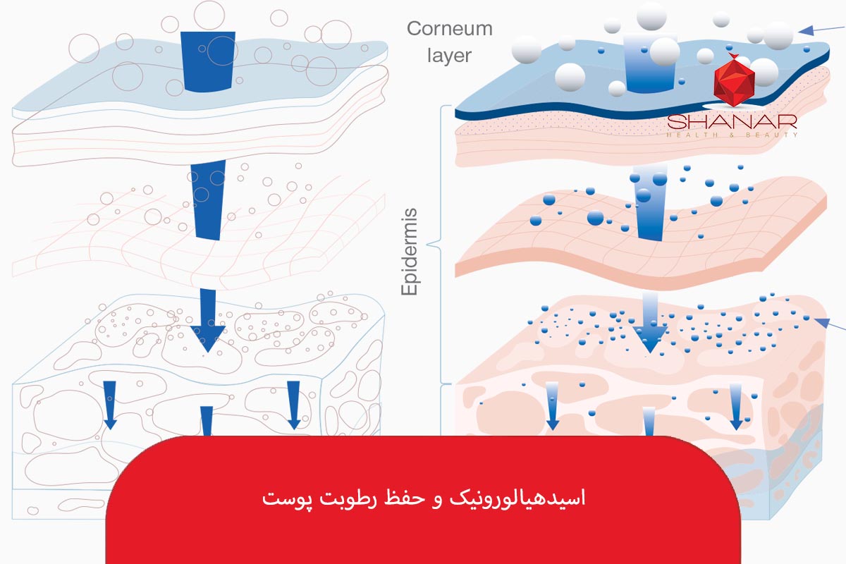 اسیدهیالورونیک-و-حفظ-رطوبت-پوست